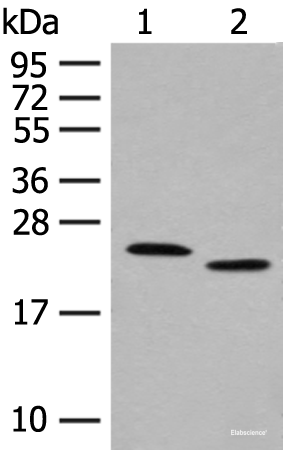 Western blot analysis of Human fat tissue and A375 cell lysates using FAM213A Polyclonal Antibody at dilution of 1:400