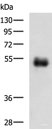 Western blot analysis of Human colorectal cancer tissue lysate using METTL17 Polyclonal Antibody at dilution of 1:700
