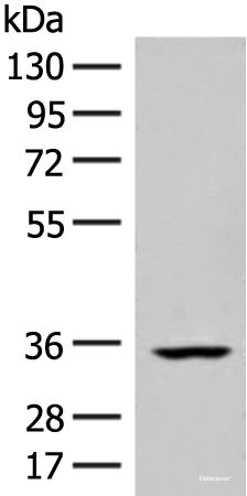 Western blot analysis of Human heart tissue lysate using FBXO16 Polyclonal Antibody at dilution of 1:400