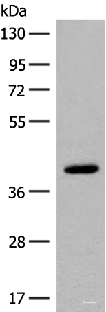 Western blot analysis of Human placenta tissue lysate using FCGRT Polyclonal Antibody at dilution of 1:400