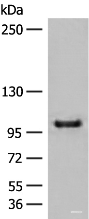 Western blot analysis of HEPG2 cell lysate using CTDP1 Polyclonal Antibody at dilution of 1:500