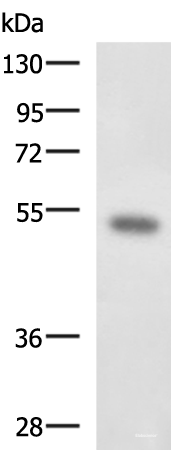 Western blot analysis of Mouse kidney tissue lysate using FOXQ1 Polyclonal Antibody at dilution of 1:650