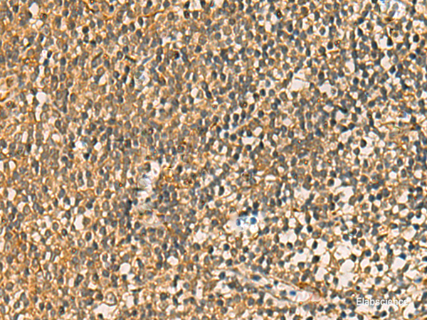 Immunohistochemistry of paraffin-embedded Human tonsil tissue using FAAP100 Polyclonal Antibody at dilution of 1:50(×200)