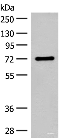 Western blot analysis of Rat brain tissue lysate using SLC6A11 Polyclonal Antibody at dilution of 1:500