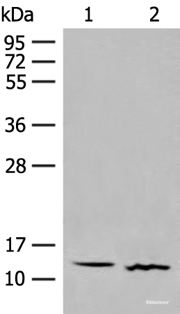 Western blot analysis of Human fetal brain tissue and Mouse thymus tissue lysates using GALP Polyclonal Antibody at dilution of 1:500