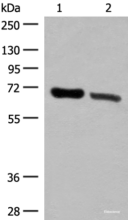 Western blot analysis of Human placenta tissue and Human fetal brain tissue lysates using TRIM8 Polyclonal Antibody at dilution of 1:500