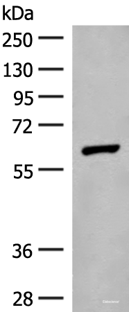 Western blot analysis of Mouse liver tissue lysate using GLS2 Polyclonal Antibody at dilution of 1:400
