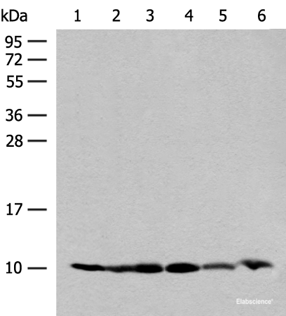 Western blot analysis of 293T and PC3 cell Mouse spleen tissue 231 cell Human breast cancer tissue Mouse kidney tissue lysates using RPS28 Polyclonal Antibody at dilution of 1:200