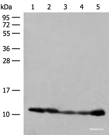 Western blot analysis of 293T cell PC-3 cell Human liver tissue lysates using ATP5I Polyclonal Antibody at dilution of 1:400