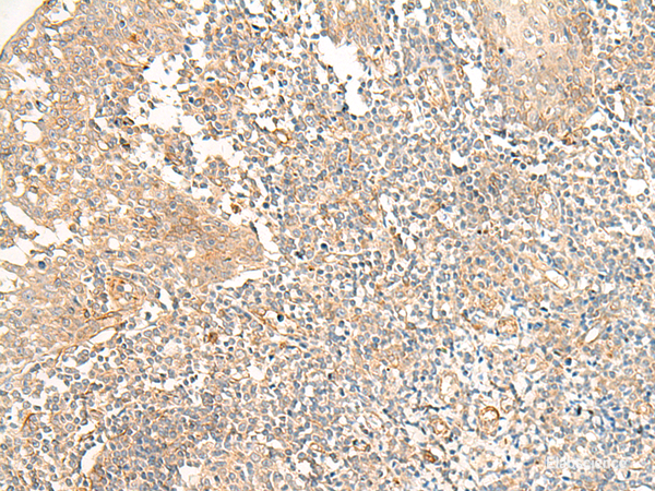 Immunohistochemistry of paraffin-embedded Human tonsil tissue using PTGDR2 Polyclonal Antibody at dilution of 1:30(×200)
