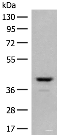 Western blot analysis of Human fetal brain tissue lysate using TAAR2 Polyclonal Antibody at dilution of 1:350