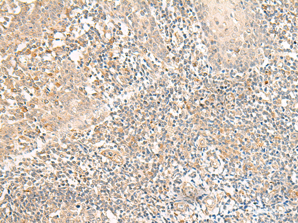 Immunohistochemistry of paraffin-embedded Human tonsil tissue using GPR157 Polyclonal Antibody at dilution of 1:50(×200)