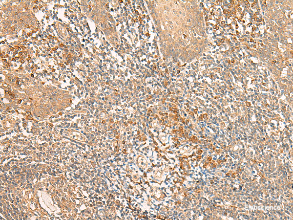 Immunohistochemistry of paraffin-embedded Human tonsil tissue using WLS Polyclonal Antibody at dilution of 1:50(×200)