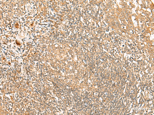 Immunohistochemistry of paraffin-embedded Human tonsil tissue using PROKR1 Polyclonal Antibody at dilution of 1:40(×200)