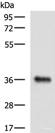 Western blot analysis of Mouse liver tissue lysate using GRHPR Polyclonal Antibody at dilution of 1:900