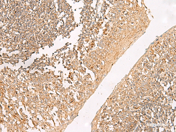 Immunohistochemistry of paraffin-embedded Human tonsil tissue using GRIK5 Polyclonal Antibody at dilution of 1:35(×200)