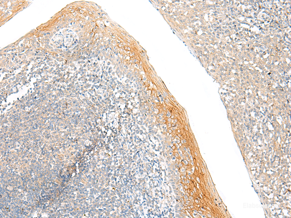 Immunohistochemistry of paraffin-embedded Human tonsil tissue using FAM110D Polyclonal Antibody at dilution of 1:60(×200)