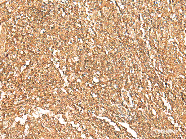 Immunohistochemistry of paraffin-embedded Human tonsil tissue using GTF3A Polyclonal Antibody at dilution of 1:75(×200)