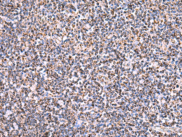 Immunohistochemistry of paraffin-embedded Human tonsil tissue using HSF2BP Polyclonal Antibody at dilution of 1:30(×200)
