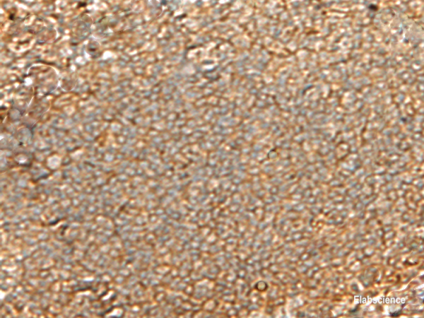 Immunohistochemistry of paraffin-embedded Human tonsil tissue using GNGT2 Polyclonal Antibody at dilution of 1:40(×200)