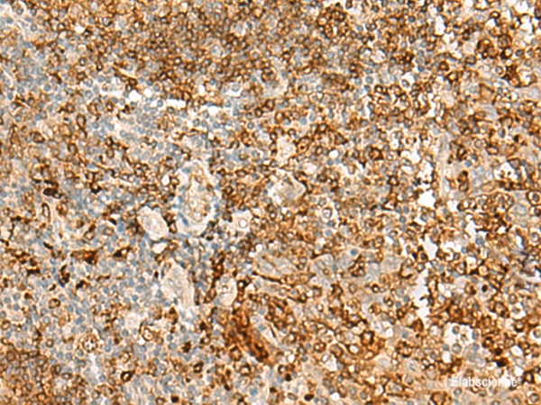 Immunohistochemistry of paraffin-embedded Human tonsil tissue using HLA-DRB1 Polyclonal Antibody at dilution of 1:35(×200)