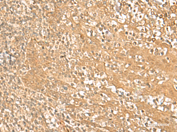 Immunohistochemistry of paraffin-embedded Human tonsil tissue using HMBOX1 Polyclonal Antibody at dilution of 1:30(×200)
