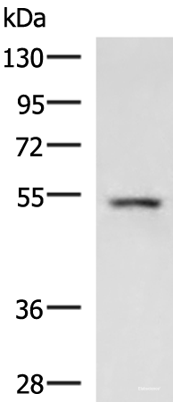 Western blot analysis of Rat liver tissue lysate using ONECUT1 Polyclonal Antibody at dilution of 1:600