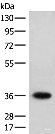 Western blot analysis of Jurkat cell lysate using HOXC12 Polyclonal Antibody at dilution of 1:500