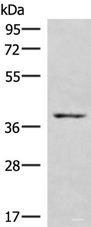 Western blot analysis of NIH/3T3 cell lysate using HOXD9 Polyclonal Antibody at dilution of 1:1000