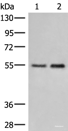 Western blot analysis of Human placenta tissue and 231 cell lysates using HTRA4 Polyclonal Antibody at dilution of 1:400