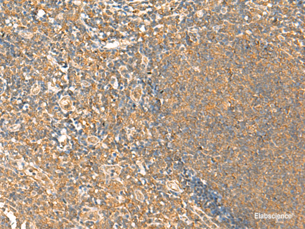Immunohistochemistry of paraffin-embedded Human tonsil tissue using HTT Polyclonal Antibody at dilution of 1:25(×200)