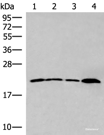 Western blot analysis of 231 cell Human breast cancer tissue Raji cell Human fetal liver tissue lysates using IFNA5 Polyclonal Antibody at dilution of 1:400