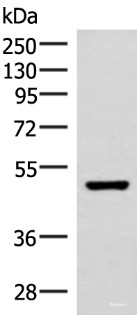 Western blot analysis of Mouse brain tissue lysate using IP6K2 Polyclonal Antibody at dilution of 1:500