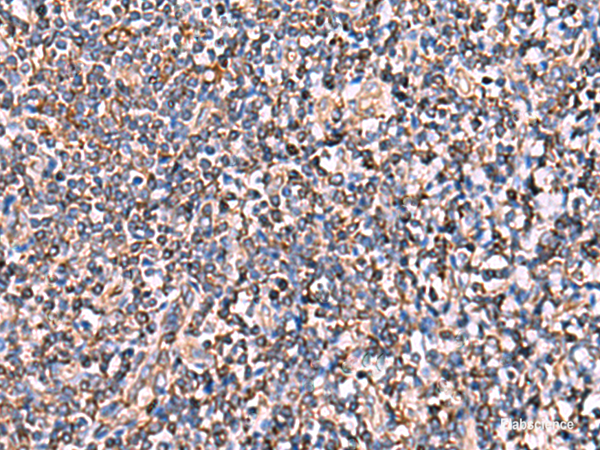 Immunohistochemistry of paraffin-embedded Human tonsil tissue using INSC Polyclonal Antibody at dilution of 1:65(×200)