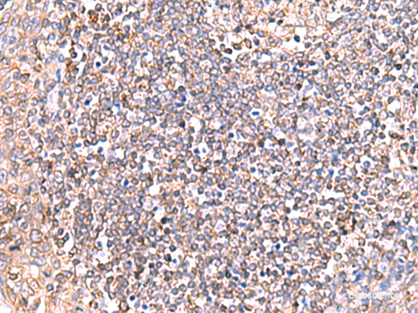Immunohistochemistry of paraffin-embedded Human tonsil tissue using GRIA2 Polyclonal Antibody at dilution of 1:50(×200)