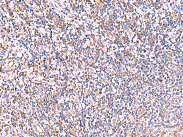 Immunohistochemistry of paraffin-embedded Human tonsil tissue using ITPKC Polyclonal Antibody at dilution of 1:40(×200)