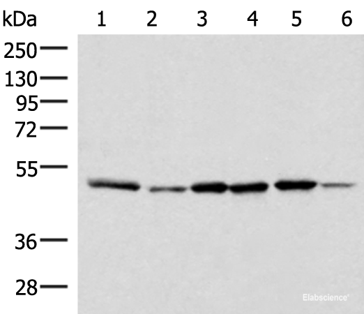 Western blot analysis of Jurkat PC-3 HepG2 Hela HT-29 and Raji cell lysates using IP6K1 Polyclonal Antibody at dilution of 1:400