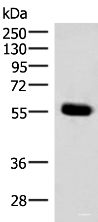 Western blot analysis of Mouse pancreas tissue lysate using IPPK Polyclonal Antibody at dilution of 1:350
