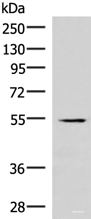 Western blot analysis of Human heart tissue lysate using IRX1 Polyclonal Antibody at dilution of 1:300
