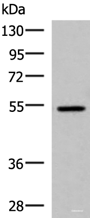 Western blot analysis of HepG2 cell lysate using ISM1 Polyclonal Antibody at dilution of 1:1000