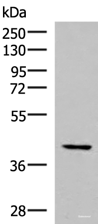 Western blot analysis of Hela cell lysate using IST1 Polyclonal Antibody at dilution of 1:1000