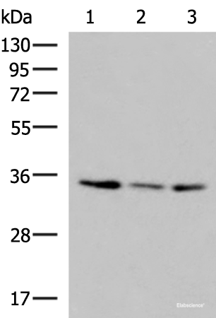 Western blot analysis of HepG2 HL60 cell Human fetal liver tissue lysates using ISY1-RAB43 Polyclonal Antibody at dilution of 1:1000
