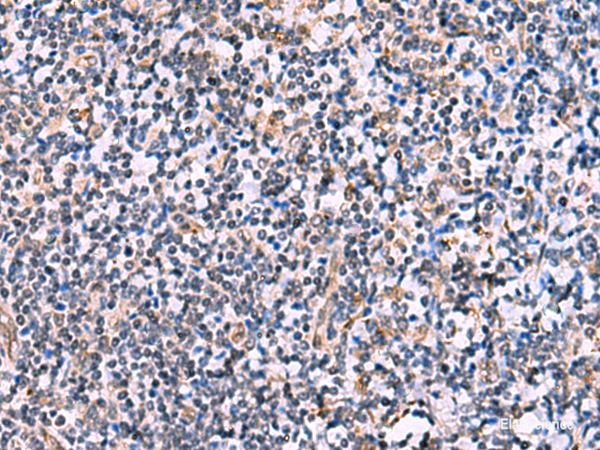 Immunohistochemistry of paraffin-embedded Human tonsil tissue using NMRK2 Polyclonal Antibody at dilution of 1:55(×200)