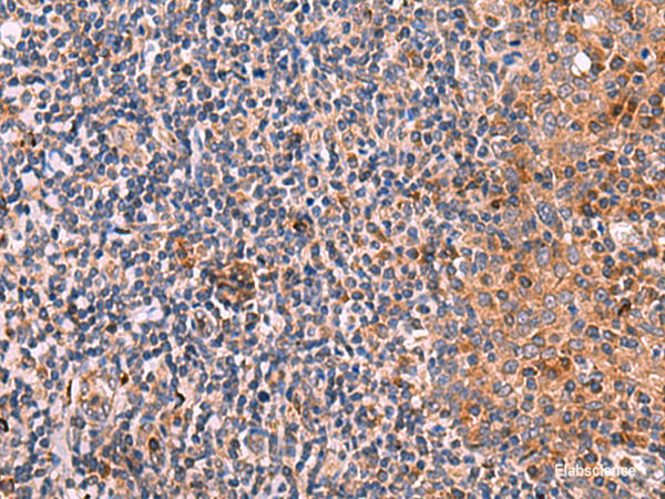 Immunohistochemistry of paraffin-embedded Human tonsil tissue using KLK9 Polyclonal Antibody at dilution of 1:50(×200)