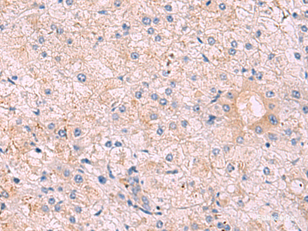 Immunohistochemistry of paraffin-embedded Human tonsil tissue using KANSL1L Polyclonal Antibody at dilution of 1:40(×200)