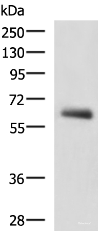 Western blot analysis of Human metastatic papillary carcinoma(thyroid cancer) tissue lysate using KBTBD11 Polyclonal Antibody at dilution of 1:2300