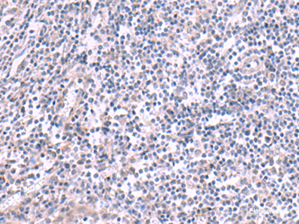 Immunohistochemistry of paraffin-embedded Human tonsil tissue using KCNK10 Polyclonal Antibody at dilution of 1:45(×200)