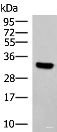 Western blot analysis of Hela cell lysate using KCTD7 Polyclonal Antibody at dilution of 1:1200