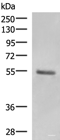 Western blot analysis of Human skin tissue lysate using KRT36 Polyclonal Antibody at dilution of 1:1000