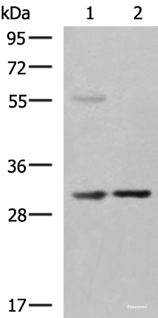 Western blot analysis of Human fetal liver tissue Jurkat cell lysates using KHK Polyclonal Antibody at dilution of 1:550